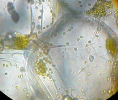 Chlorophyll in the Plant Cells