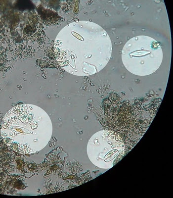 Micro Organisms living in the water