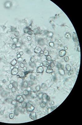 The Wonderful Microworld: Milk and the Curd (Fermented Milk) through ...