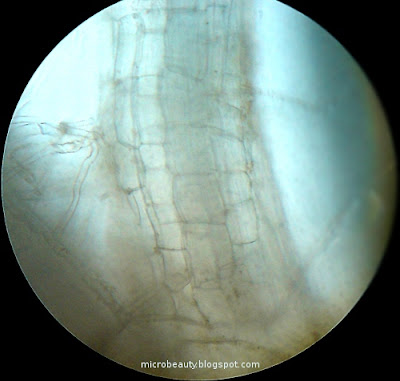 Root Cells
