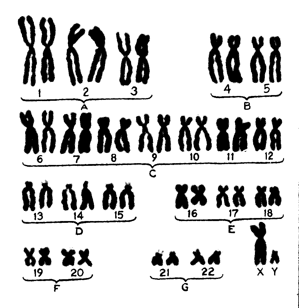 Кариотип человека 46 хромосом. Нормальный кариотип хромосомы. Набор хромосом у человека 46 хромосом. Схема идентификации хромосом человека.