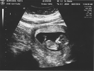 Scott & Tanya's Pregnancy blog: 12 Week Sonogram