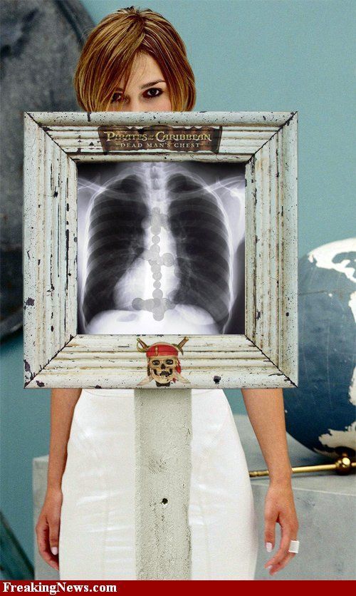 Celebrity xray pics (Photoshopped) Funny & Crazy.