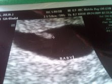 First Ultrasound