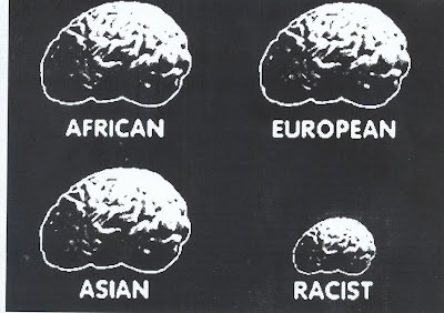 Racist brain