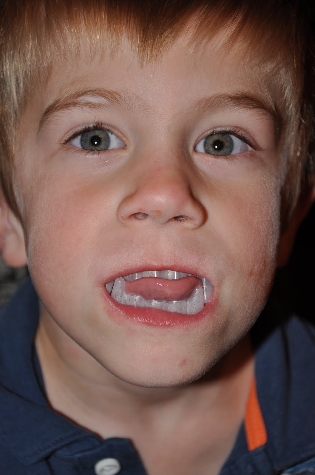 The Siple Family Vampire teeth