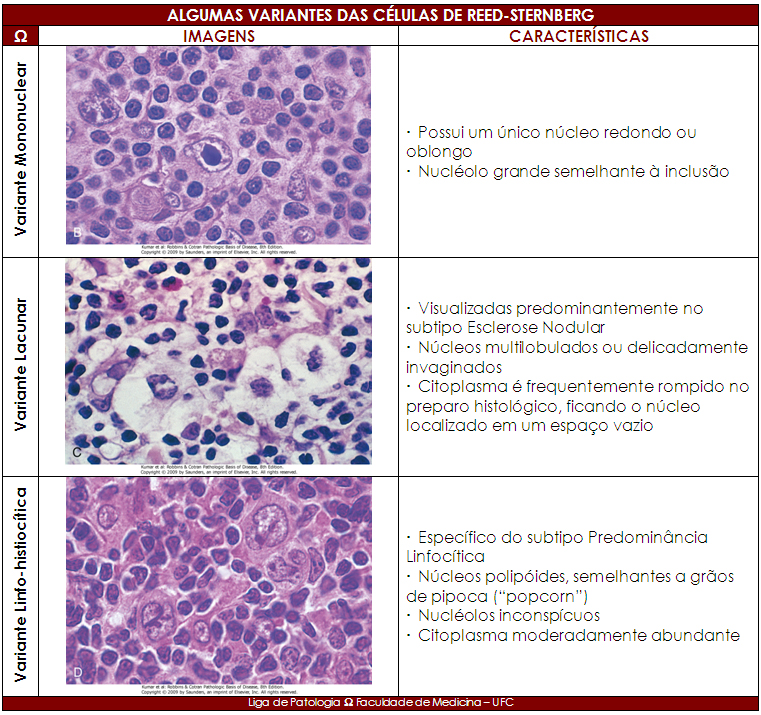 Liga de Patologia UFC LINFOMA DE HODGKIN Liga de Patologia UFC LINFOMA DE HODGKIN