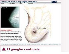 El Gánglio Centinela