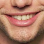 ¿QUÉ ES UNA PRÓTESIS DENTAL?