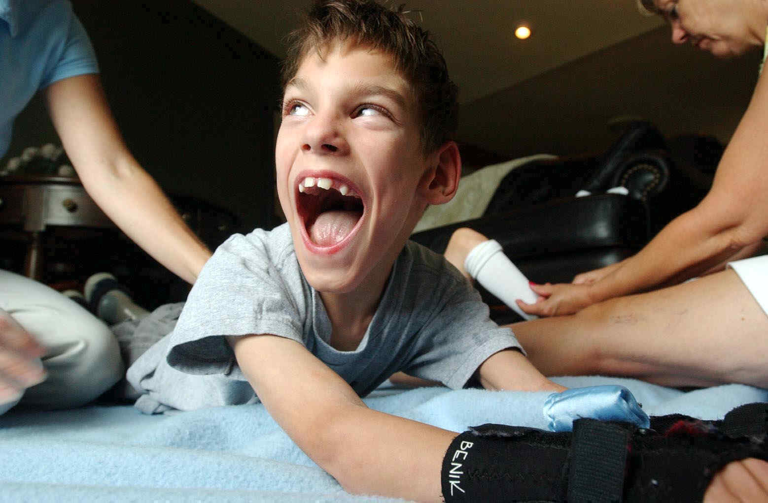 Cerebral Palsy - Pictures