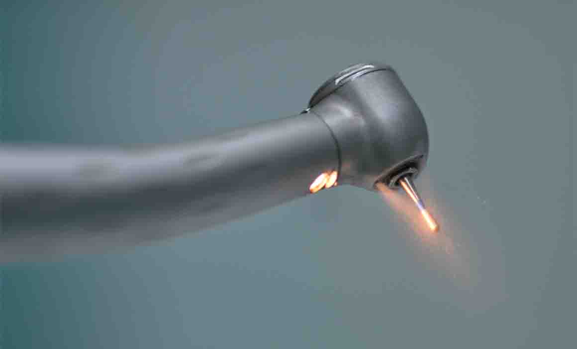 Treatment Options Dental Filling