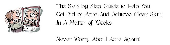 Get Rid of Acne Now