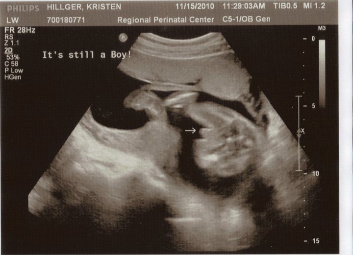 Baby Ultrasound Baby Ultrasound Quiz