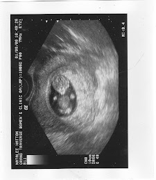 Baby #3's Early Ultrasound