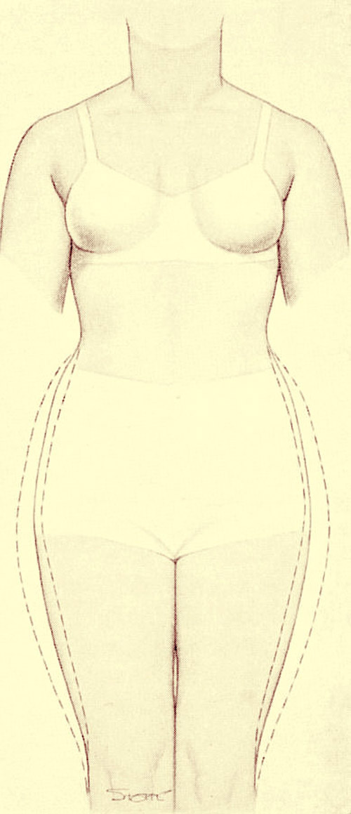 [SIDE+HIP.jpg]