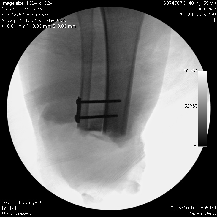 Gimp X Ray How to Get an Xray Effect in GIMP Small Business