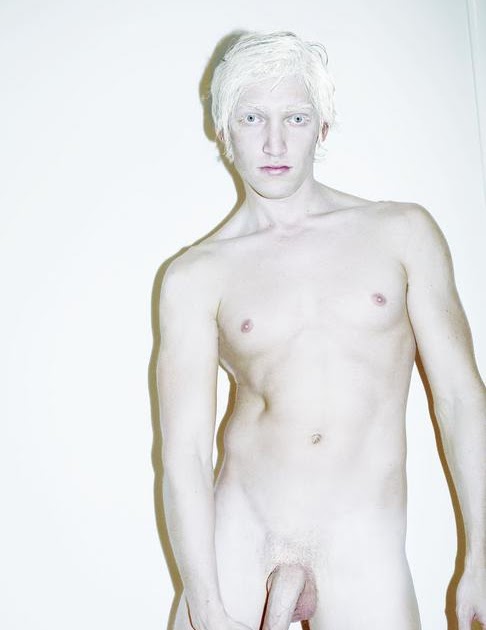 Pictures Of Naked Black Albino Girls