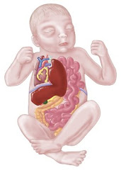 Example of an infant with CDH