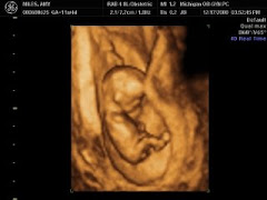 4D ultrasound at 11 1/2 weeks