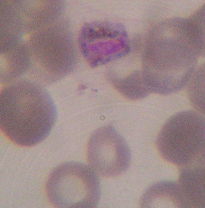 a malária plazmodium skizogóniájának stádiumai)