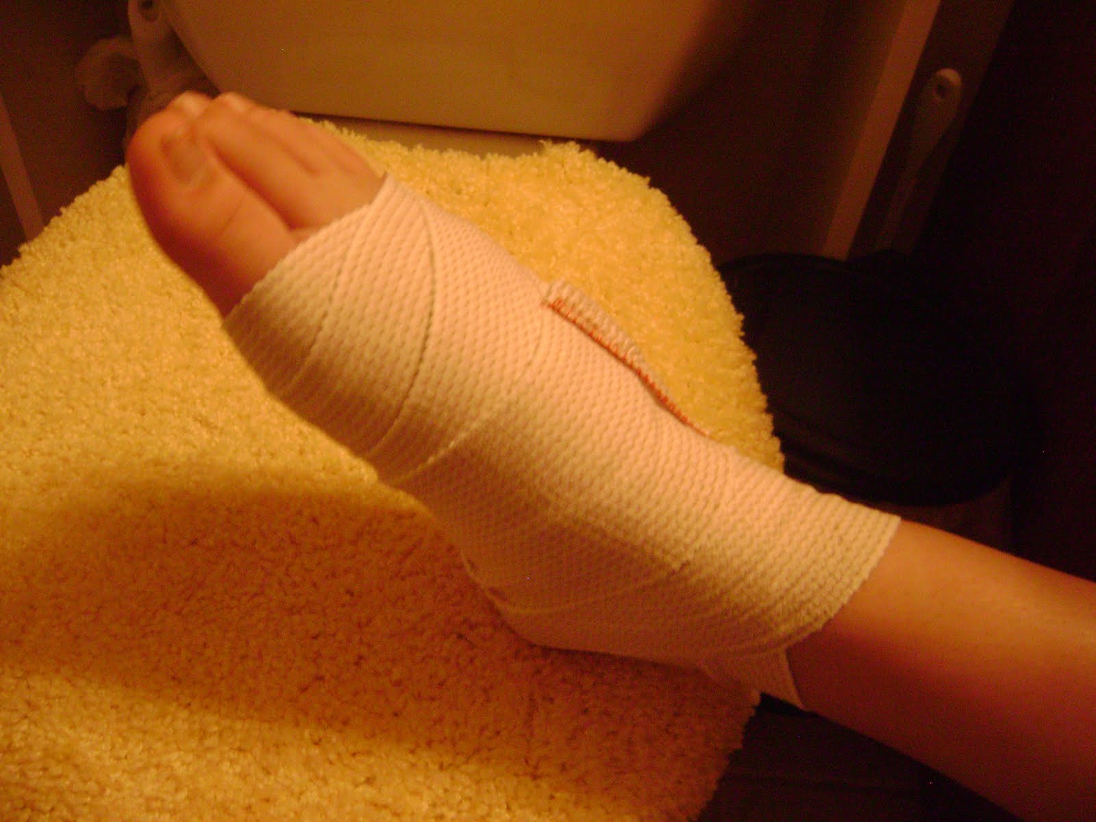 Beautiful MY BROKEN FOOT