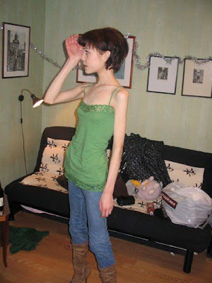 Most Amazing Photos from the World Cultures Horrors of Anorexia
