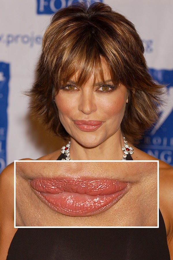 [celebrity_microscope_47.jpg]