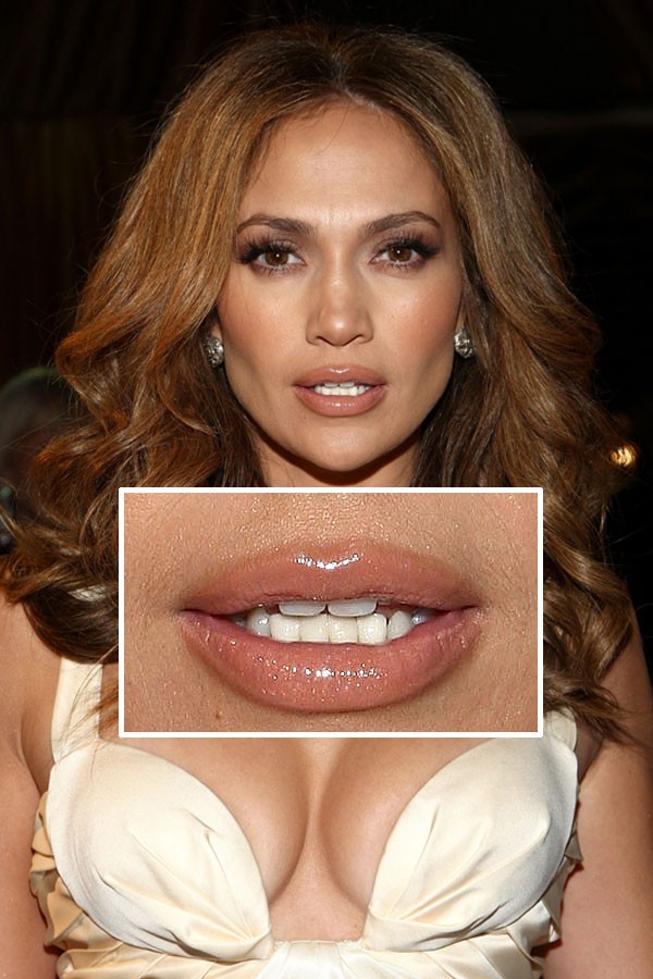 [celebrity_microscope_11.jpg]