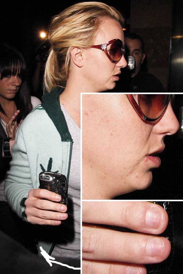 [celebrity_microscope_07.jpg]