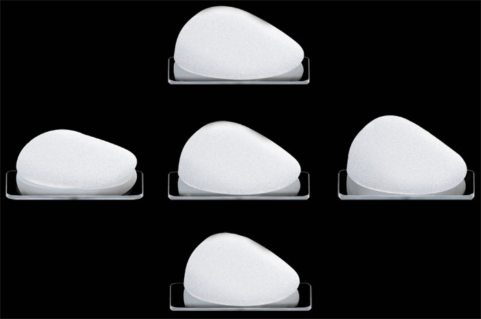 импланты грудные ментор 330. импланты ментор 250сс. ментор анатомы. анатомические импланты ментор 335 мл. ментор анатомы.