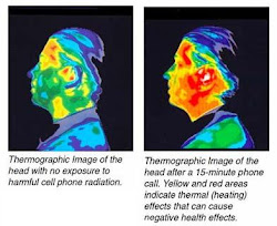 THERMOGRAPHIC PICTURE OF MOBILE PHONE USE BEFORE AND AFTER 15 MINUTE