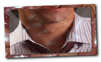 Изображение - Влияние щитовидной железы на суставы schitividka