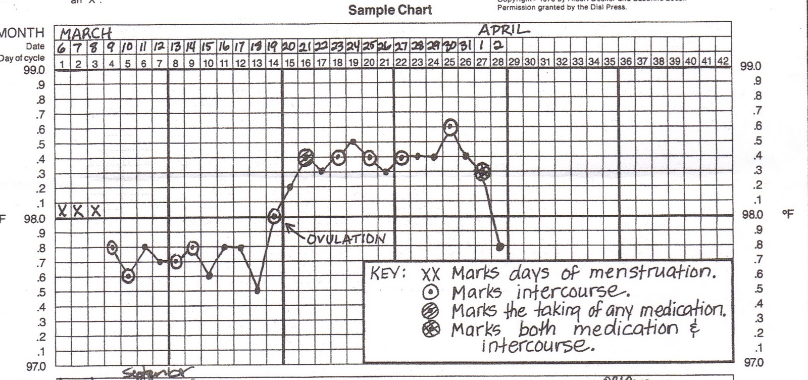 Infertile Tif Basal Temperature!