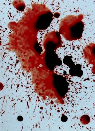 [BloodSpatterPhoto.JPG]