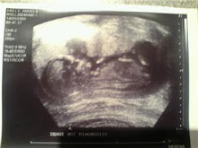 13 week scan