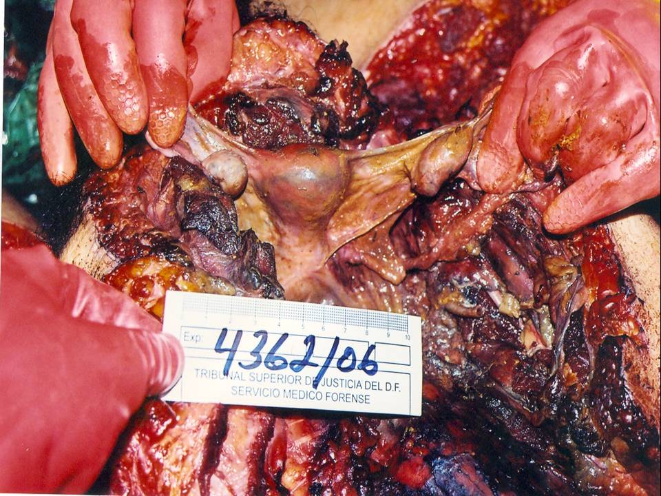 [La+novia+muerta+(006).JPG]