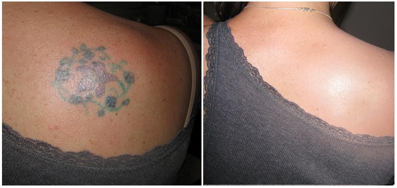 1. Tattoo Cover Up Makeup - wide 11
