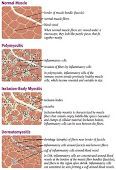 What our muscles look like