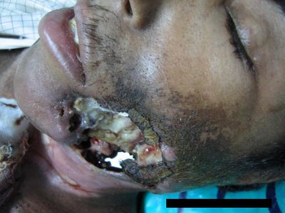 How+To+Stop+Smoking++Quit+Cigarettes++Best+Way+Stop+Effects+%25281%2529.jpg