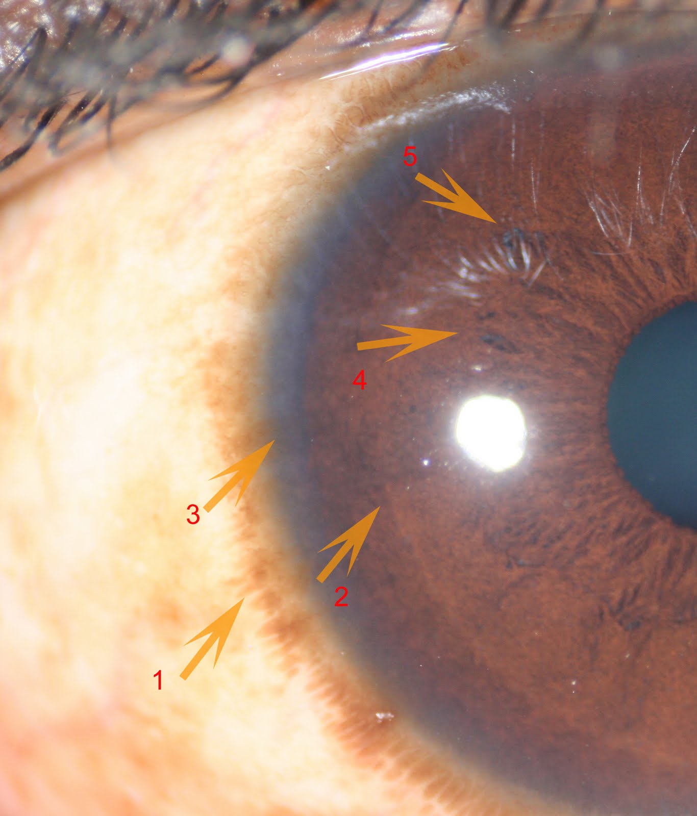Modern & Multidimensional Iridology Physical Iridology Analysis