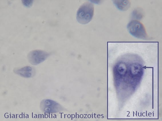 bacterii giardia lambia cum să scapi de fergusele din corp