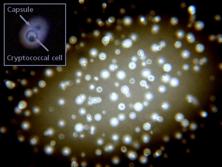 Fun With Microbiology (What's Buggin' You?): Cryptococcus neoformans