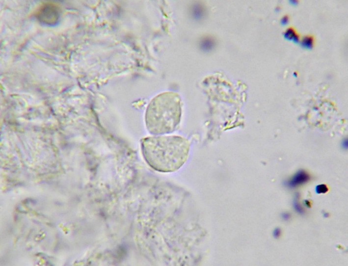 Trichomonas cocci