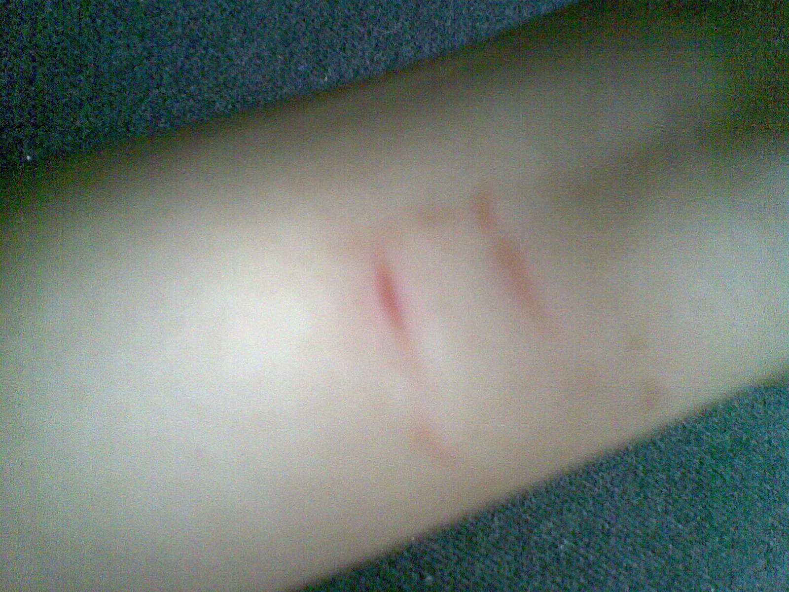 30 Gambar Tangan Berdarah Di Silet Terbaru Riwayat Gallery