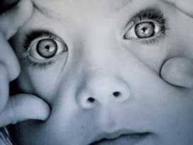 [göz+tembelliği.jpg]