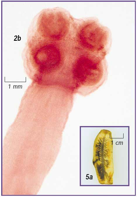 [taeniasaginata.jpg]