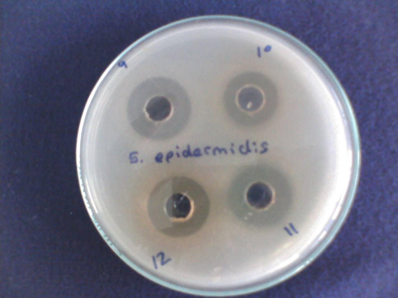 microbiologia y farmacia: Antimicrobial activity of four plants from