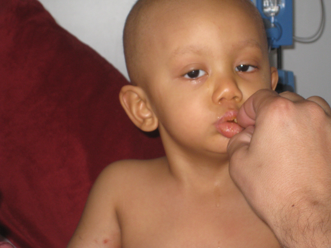 [Cancer-French-Fry.jpg]