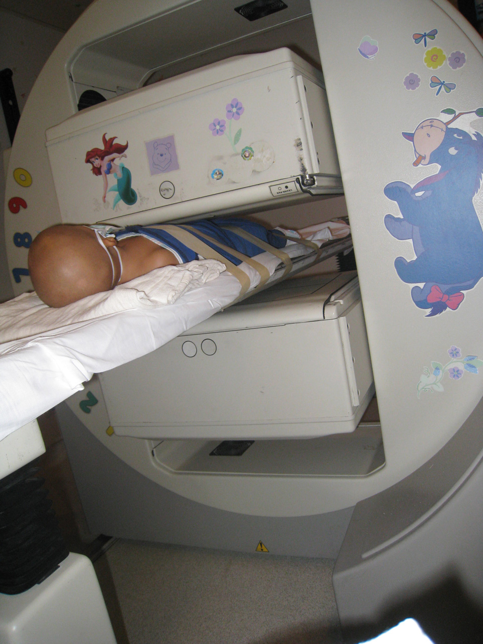 [Leukemia-Bone-Scan.jpg]