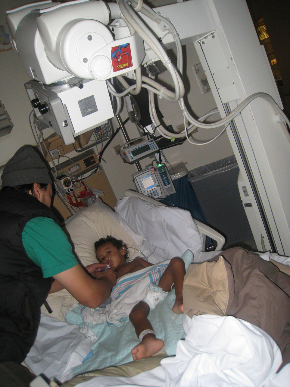 [Chest-Xray-Relapse.jpg]